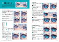 How To Draw Bright Eyes thumbnail 8