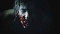 Resident Evil 2 / Biohazard Re: 2 <span class="ext ext_Xbox Play Anywhere">Xbox®️ Play Anywhere</span> <span class="ext ext_digital">digital</span> thumbnail 6